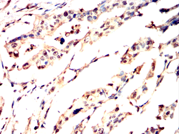 NFKBIA Antibody