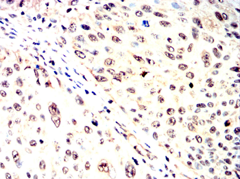 FOXP3 Antibody
