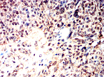 FOXP3 Antibody