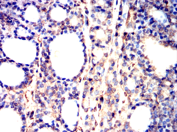 FOXP3 Antibody