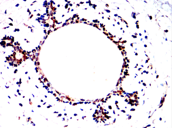 MAP2K1 Antibody