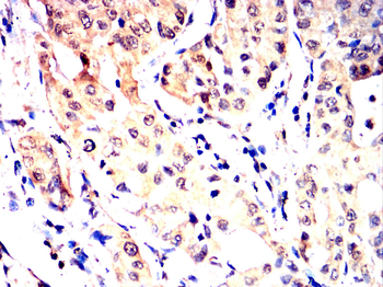 MAP2K1 Antibody
