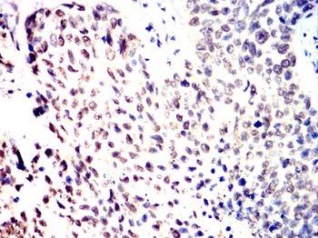 MAP2K1 Antibody