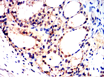 MAP2K1 Antibody