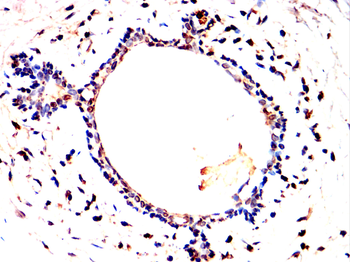LIG4 Antibody