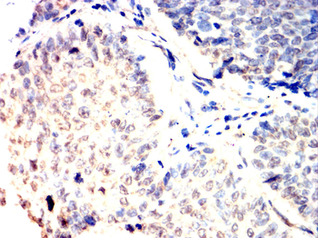 LIG4 Antibody