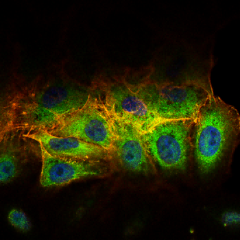 SDHA Antibody