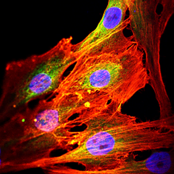 GPX1 Antibody