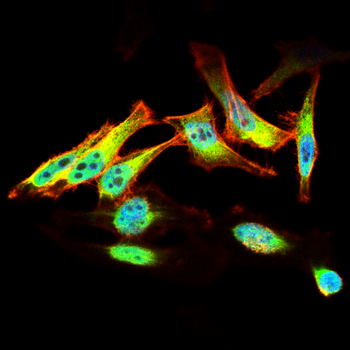 BRIP1 Antibody