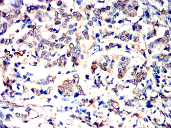 BRIP1 Antibody
