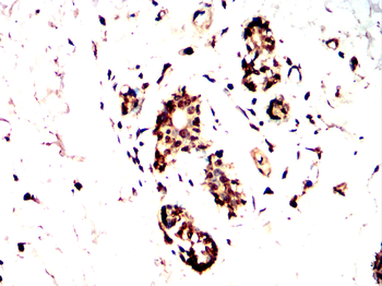 BRIP1 Antibody