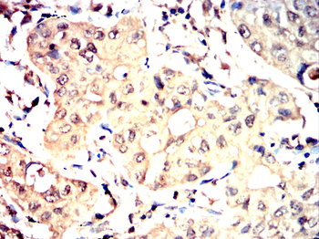 BRIP1 Antibody