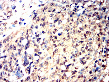 BRIP1 Antibody