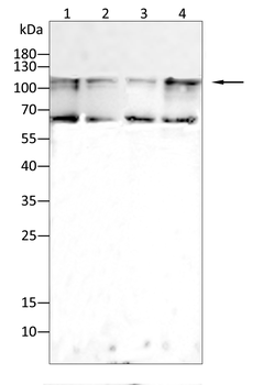 BRIP1 Antibody