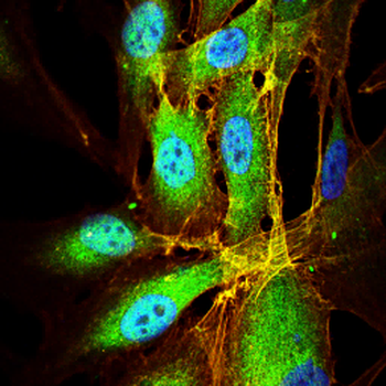 PKHD1 Antibody