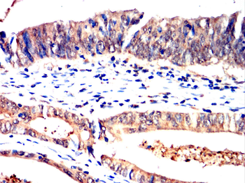 PKHD1 Antibody