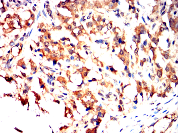 PKHD1 Antibody