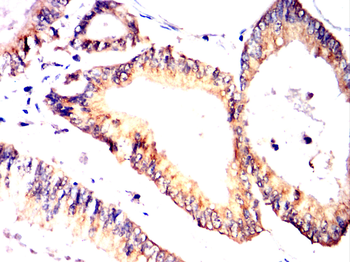 CTTN Antibody