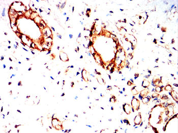 CTTN Antibody