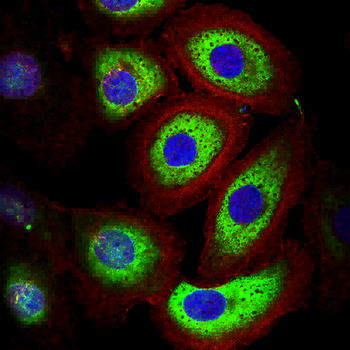 MMP11 Antibody