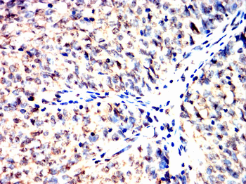 HNRNPK Antibody
