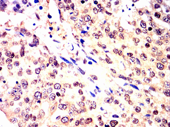 EIF2AK2 Antibody