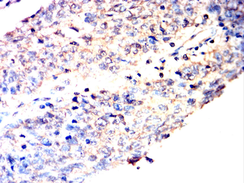 PICK1 Antibody