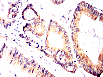 PICK1 Antibody