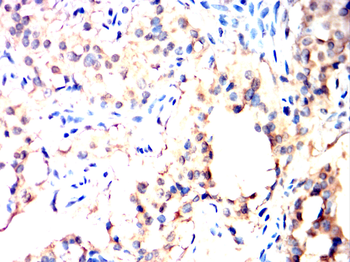 PICK1 Antibody