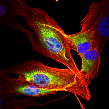 PLIN1 Antibody