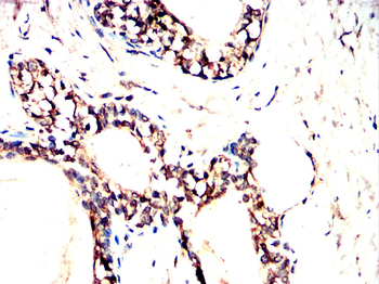 PLIN1 Antibody