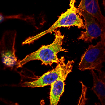 GSN Antibody