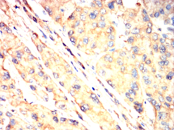 GSN Antibody