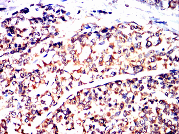 GSN Antibody