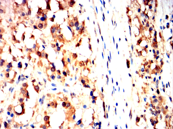 GSN Antibody