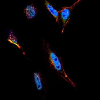 TOP1 Antibody