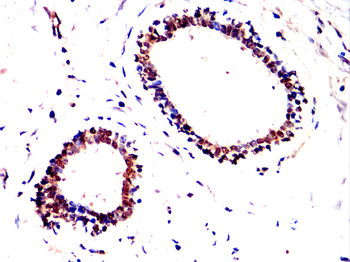 TOP1 Antibody
