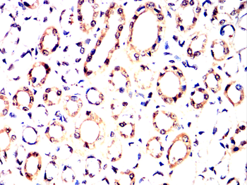 TOP1 Antibody
