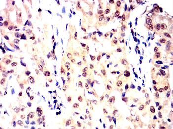 TOP1 Antibody