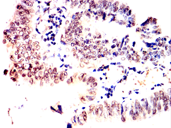 TOP1 Antibody