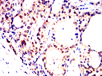 TOP1 Antibody