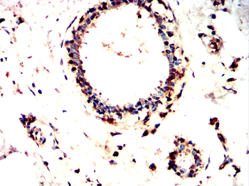 EZH2 Antibody