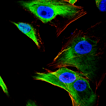 FTH1 Antibody