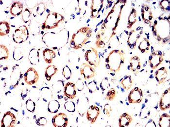 FTH1 Antibody