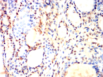 FTH1 Antibody