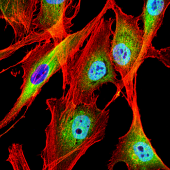 FHIT Antibody