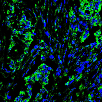 FHIT Antibody