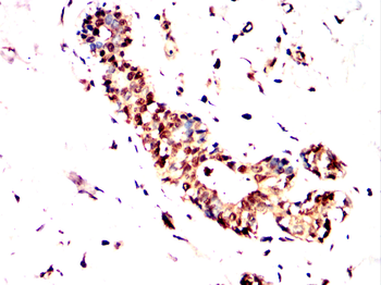FHIT Antibody