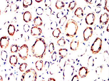 FHIT Antibody