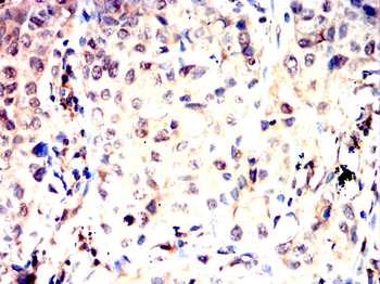 FHIT Antibody